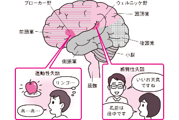 ch29_img04.png